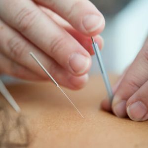 Medicina Tradicional Chinesa na Soul Bliss